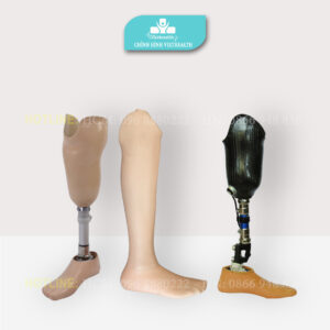 chân giả dưới gối -viethealth
