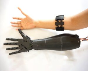 Tay giả điện sinh học(Tay robot)